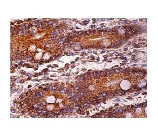 GCAP2 Antibody (G-10) - Immunohistochemistry - Image 158572 