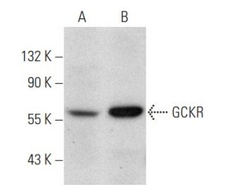 western blotting image from recommended GCKR (B-9) monoclonal antibody replacement. Image 354418