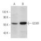 western blotting image from recommended GCKR (B-9) monoclonal antibody replacement. Image 354418