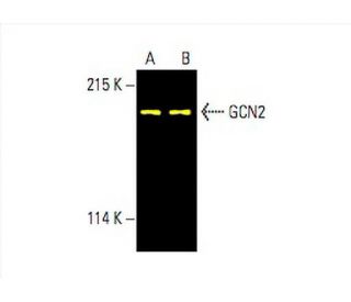 GCN2 Antibody (F-7) - Western Blotting - Image 393686