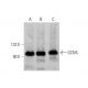 western blotting image from recommended GCN5 (A-11) monoclonal antibody replacement. Image 346633