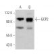 GCP2 Antibody (F-3) - Western Blotting - Image 366993 