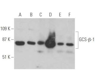 Anti Gcs B 1 Antibody G 3 Scbt Santa Cruz Biotechnology