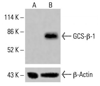 GCS-&beta;-1 Antibody (G-3) - Western Blotting - Image 415616 