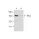 Geldanamycin: sc-200617. Western blot analysis of IKKα expression in HEK293 (A) and Geldanamycin treated HEK293 (B) whole