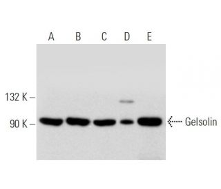 western blotting image from recommended Gelsolin (F-5) monoclonal antibody replacement. Image 320896
