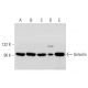 western blotting image from recommended Gelsolin (F-5) monoclonal antibody replacement. Image 320896