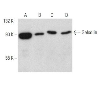 Gelsolin Antibody (F-5) - Western Blotting - Image 358472SAM Transcription Activation: SAM system utilizing dCas9-VP64, MS2-P65-HSF1, and sgRNA for precise gene transcription activation.