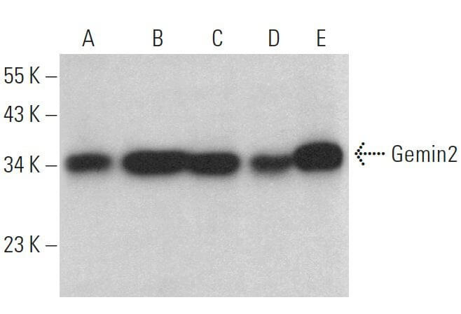 mi様ブラック2 Gemin2 Antibody (A-9) | SCBT - Santa Cruz Biotechnology