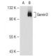 Gemin3 Antibody (2) - Western Blotting - Image 110115