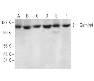 Gemin4 Antibody (17D10) - Western Blotting - Image 379215 