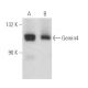 Gemin4 Antibody (A-2) - Western Blotting - Image 389869 