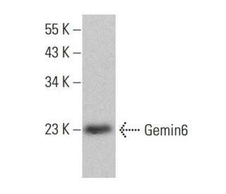 Gemin6 Antibody (20H8) - Western Blotting - Image 377636