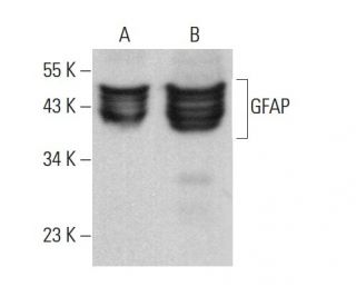 GFAP Antibody (GA-5) - Western Blotting - Image 376326 