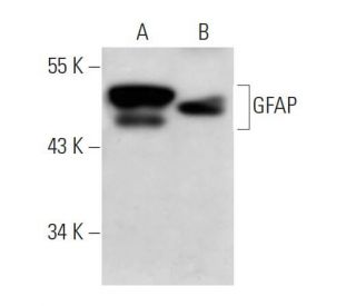 GFAP Antibody (GF5) - Western Blotting - Image 12862 
