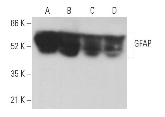 sabp様 FOXP3 Antibody (F-9) | SCBT - Santa Cruz Biotechnology