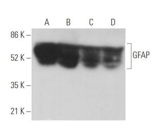 western blotting image from recommended GFAP (2E1) monoclonal antibody replacement. Image 373530