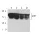 This polyclonal antibody has been discontinued. See our recommended <a href="gfap-antibody-2e1">GFAP (2E1)</a> monoclonal antibody (sample data shown). western blotting image from recommended GFAP (2E1) monoclonal antibody replacement. Image 373530