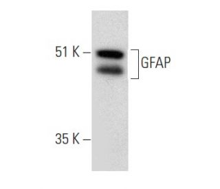 GFAP Antibody (F-2) - Western Blotting - Image 354267 