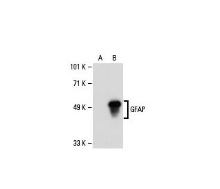 GFAP Antibody (2A5) - Western Blotting - Image 20581