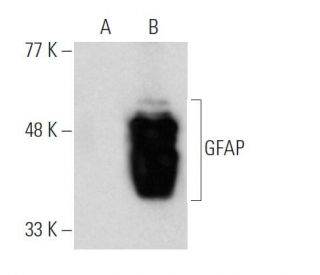 GFAP (2E1) HRP: sc-33673 HRP. Direct western blot analysis of GFAP... 