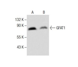 GFAT1 Antibody (D-9) - Western Blotting - Image 285022 