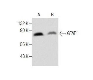 GFAT1 Antibody (D-9) - Western Blotting - Image 285022SAM Transcription Activation: SAM system utilizing dCas9-VP64, MS2-P65-HSF1, and sgRNA for precise gene transcription activation.