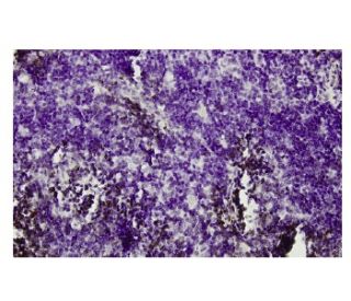 Gfi-1 Antibody (15-8) - Immunohistochemistry - Image 36272 