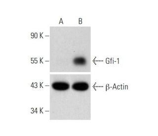 Gfi-1 Lentiviral Activation Particles: sc-401315-LAC. Western blot analysis of Gfi-1 expression in non-transduced control 