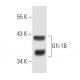 western blotting image from recommended Gfi-1B (B-7) monoclonal antibody replacement. Image 8820