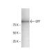 GFP Antibody (1A5) - Western Blotting - Image 156468
