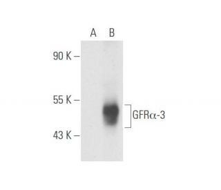 GFR&alpha;-3 Antibody (J135) - Western Blotting - Image 57067