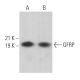 GFRP Antibody (A-8) - Western Blotting - Image 366495 