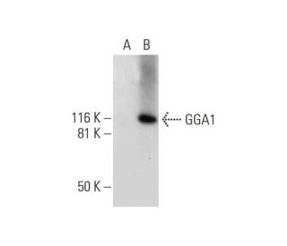 GGA1 Antibody (A-1) - Western Blotting - Image 290807