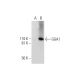 GGA1 Antibody (A-1) - Western Blotting - Image 290807