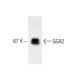 GGA2 Antibody (27) - Western Blotting - Image 60316 