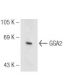 GGA2 Antibody (27) - Western Blotting - Image 93648
