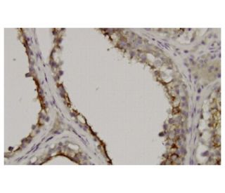 GGT1 Antibody (3E6) - Immunohistochemistry - Image 36141