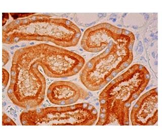 GGT1 Antibody (E-5) - Immunohistochemistry - Image 313900 