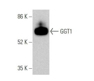 GGT1 Antibody (E-5) - Western Blotting - Image 359742