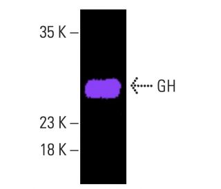 GH Antibody (E-7) | SCBT - Santa Cruz Biotechnology