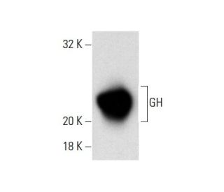 GH Antibody (GH-45) - Western Blotting - Image 137869