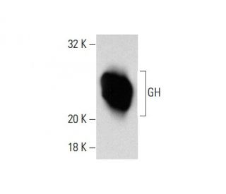 GH Antibody (GhB9) - Western Blotting - Image 137871