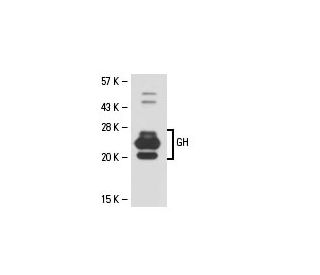 GH Antibody (NYRhGH) - Western Blotting - Image 18331 