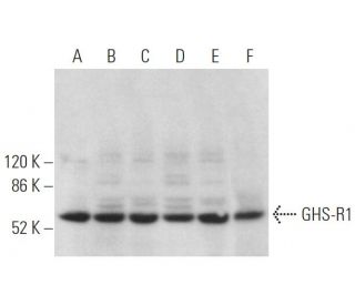 western blotting image from recommended GHS-R1 (E-7) monoclonal antibody replacement. Image 372846