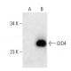 GID4 Antibody (G-10) - Western Blotting - Image 289857 