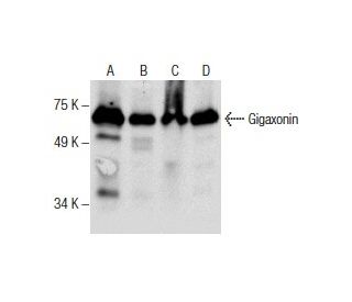 Gigaxonin Antibody (F-3) - Western Blotting - Image 285940 