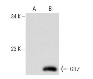 GILZ Antibody (D-2) - Western Blotting - Image 51789