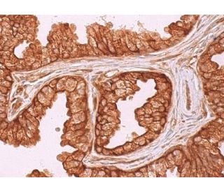 immunohistochemistry image from recommended GILZ (G-5) monoclonal antibody replacement. Image 369574