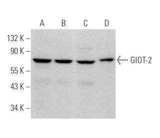 GIOT-2 Antibody (H-1) - Western Blotting - Image 375869 